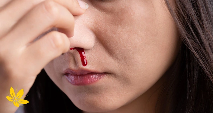 bloody nose - خون دماغ