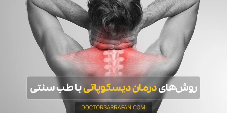treating discopathy with traditional medicine - روشهای درمان دیسکوپاتی با طب سنتی