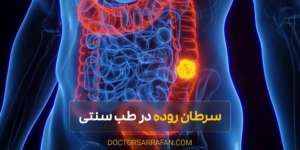 intestinal cancer traditional medicine - سرطان روده در طب سنتی