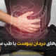 constipation treatment - روشهای درمان یبوست با طب سنتی