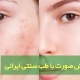 درمان جوش صورت با طب سنتی