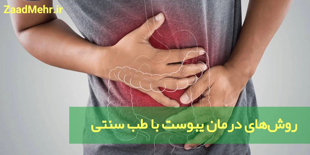 درمان یبوست با طب سنتی