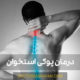 درمان پوکی استخوان - Osteoporosis treatment