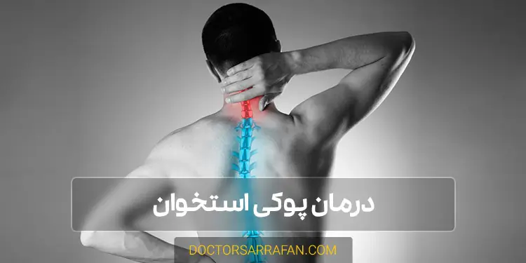 درمان پوکی استخوان - Osteoporosis treatment