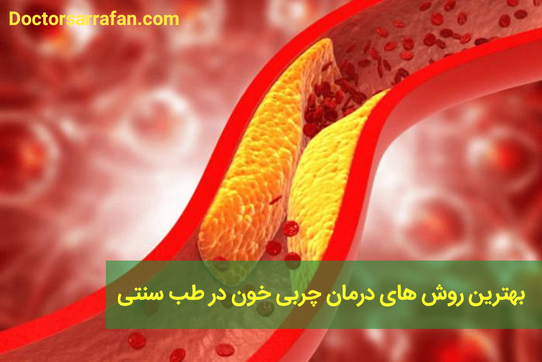 درمان چربی خون در طب سنتی