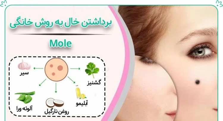 درمان خال با طب سنتی