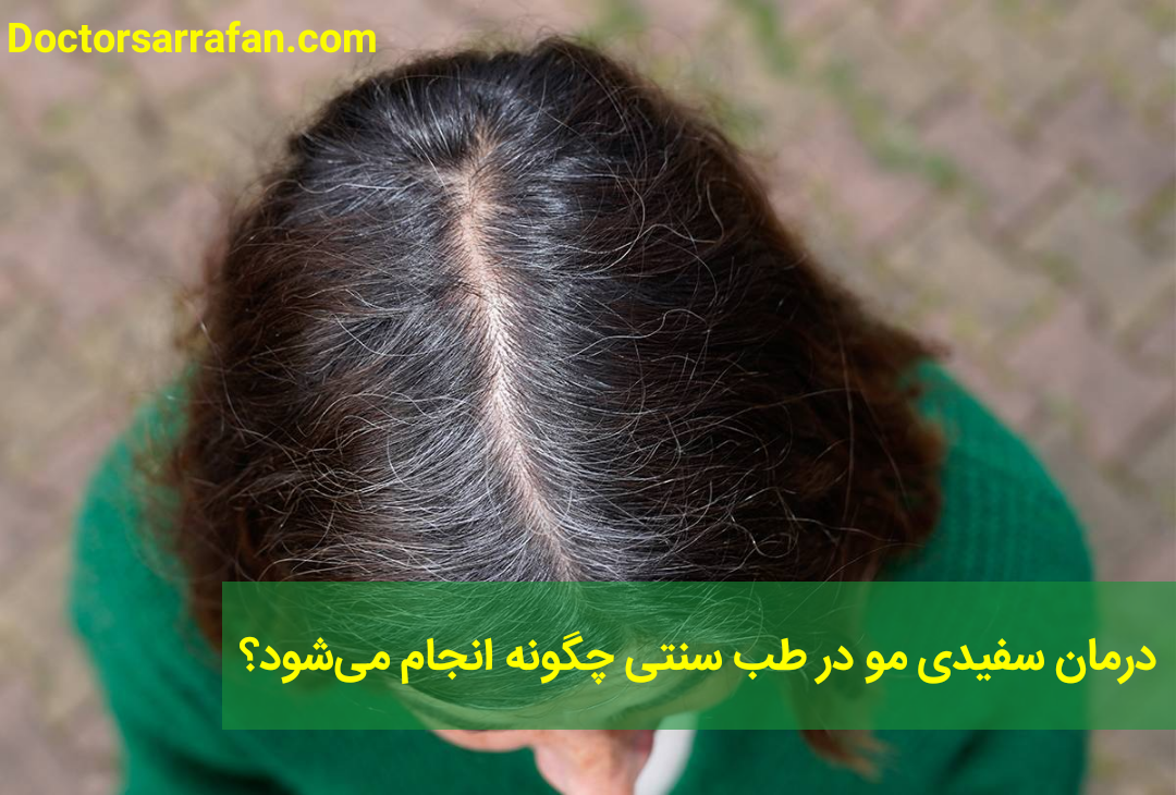 درمان سفیدی مو در طب سنتی