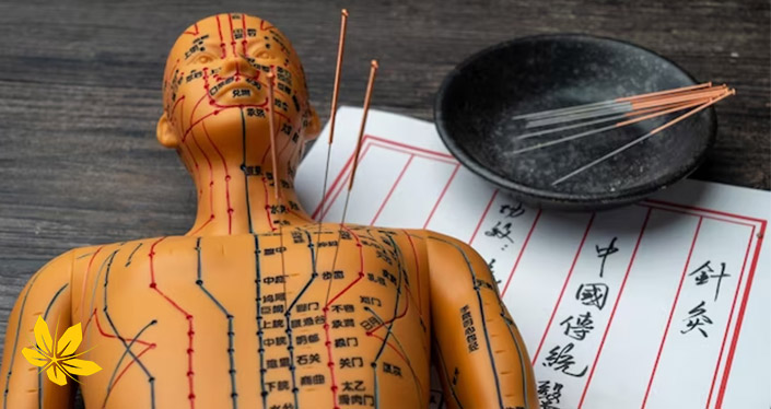 طب سوزنی برای لاغری در چین | Acupuncture for weight loss in China