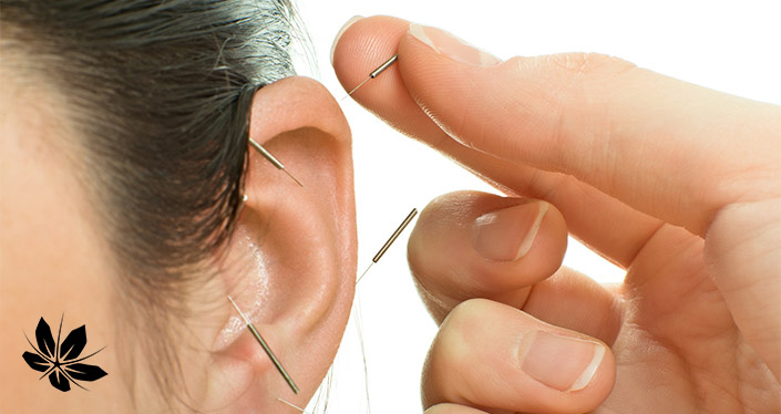 درمان گوش درد با طب سوزنی | Earache treatment with acupuncture