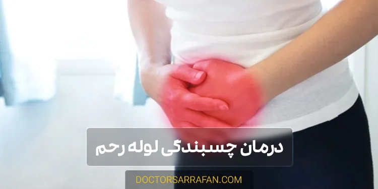 درمان چسبندگی لوله رحم | Fallopian tube adhesions treatment