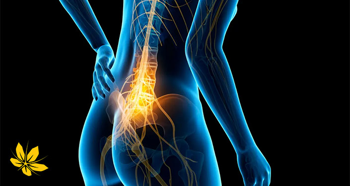 درد عصب سیاتیک | sciatic nerve pain