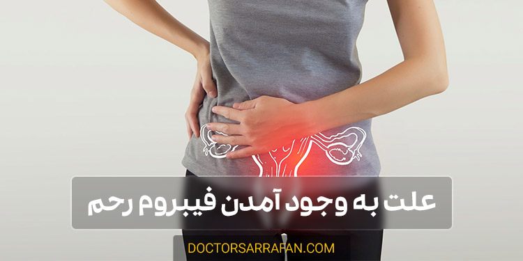 The cause of uterine fibroid disease - علت بیماری فیبروم رحم