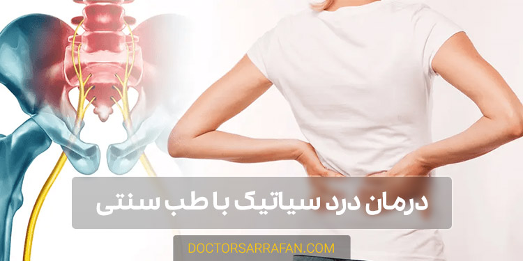درمان درد سیاتیک - Sciatica pain treatment