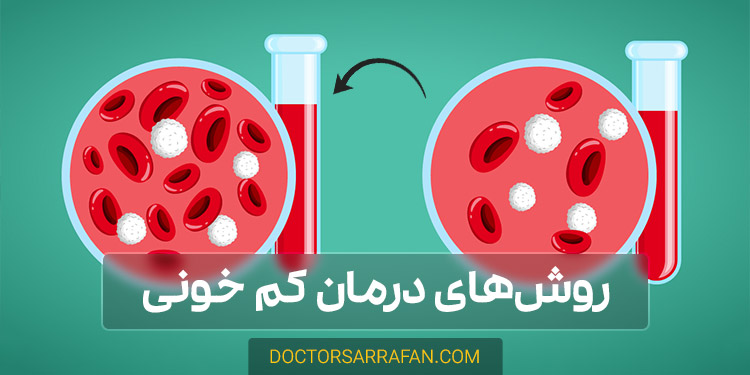 روش‌های درمان کم خونی - Anemia treatment ways