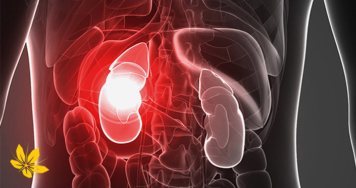 تشخیص کلیه ناسالم - Diagnosis of unhealthy kidney