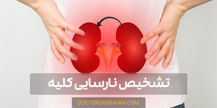 نارسایی کلیه - Kidney failure
