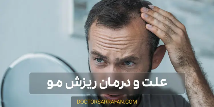 علت و درمان ریزش مو - Causes and treatment of hair loss