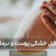 دلایل خشکی پوست و درمان - dry skin reasons and treatment