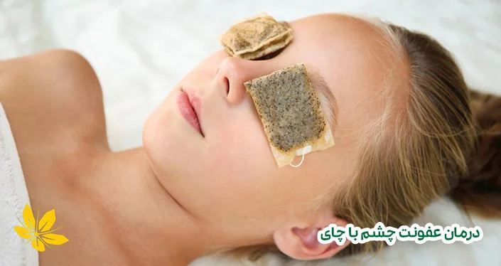 درمان عفونت چشم با چای - Eye infection treatment with tea bag
