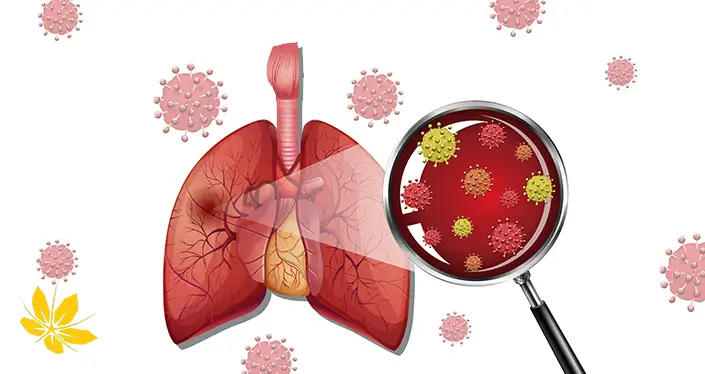 درمان ذات الریه - Pneumonia disease treatment