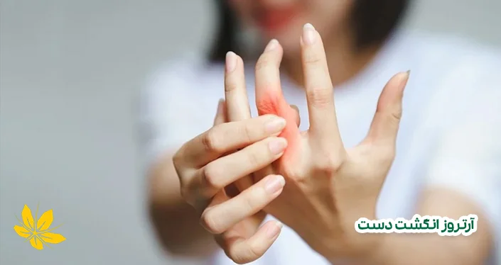 آرتروز انگشت دست - Hand finger arthritis