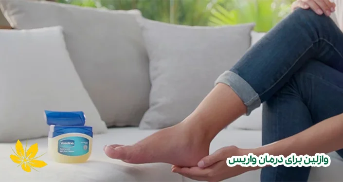 وازلین برای درمان واریس - Vaseline for varicose treatment