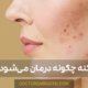 معرفی و درمان آکنه - acne introduction and treatment