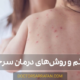 بیماری سرخک چیست؟ - What is measles disease?