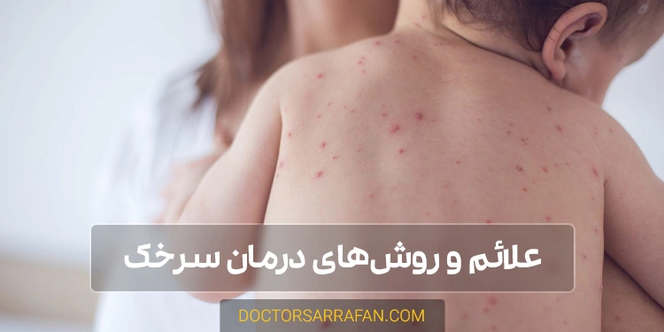 بیماری سرخک چیست؟ - What is measles disease?