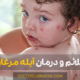 بیماری و درمان آبله مرغان - Chickenpox disease treatment