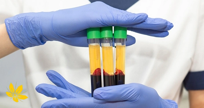 درمان خشکی واژن با پی آر پی - Vaginal dryness treatment with PRP