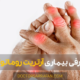 آرتریت روماتوئید - Rheumatoid arthritis