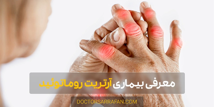 آرتریت روماتوئید - Rheumatoid arthritis