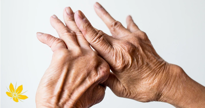 آرتریت روماتوئید چیست - What is rheumatoid arthritis