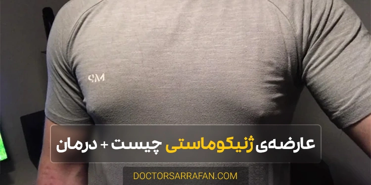 ژنیکوماستی - Gynecomastia