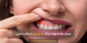 Treatment of facial swelling due to toothache - درمان ورم صورت در اثر دندان درد