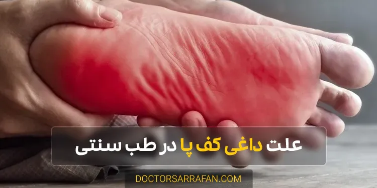 Causes of hot soles of feet - علت داغی کف پا