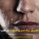 Excessive sweating of the head and face - تعریق بیش از حد سر و صورت