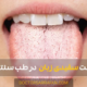 The cause of white tongue - علت سفیدی زبان
