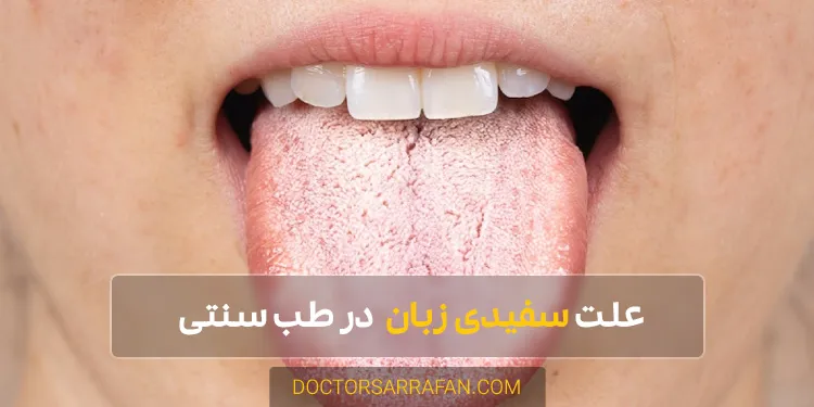 The cause of white tongue - علت سفیدی زبان