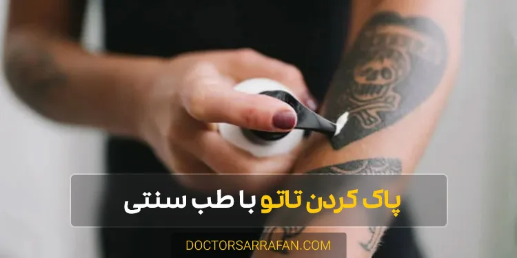 Tattoo removal - پاک کردن تاتو